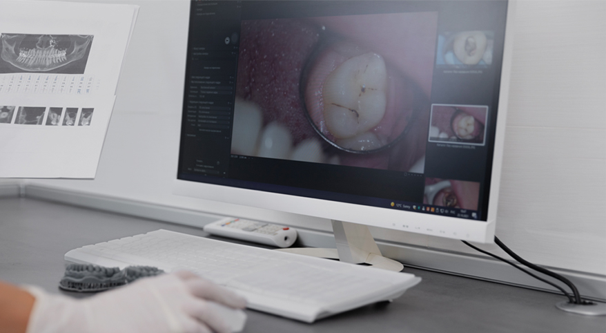 서울이로운치과 3D 구강 스캐너